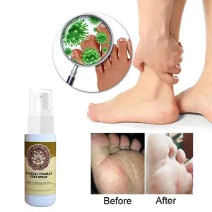 Anti-Fungal Treatment Spray Fungal Combat Feet Spray