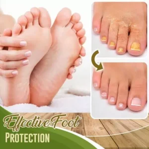Anti-Fungal Treatment Spray Fungal Combat Feet Spray