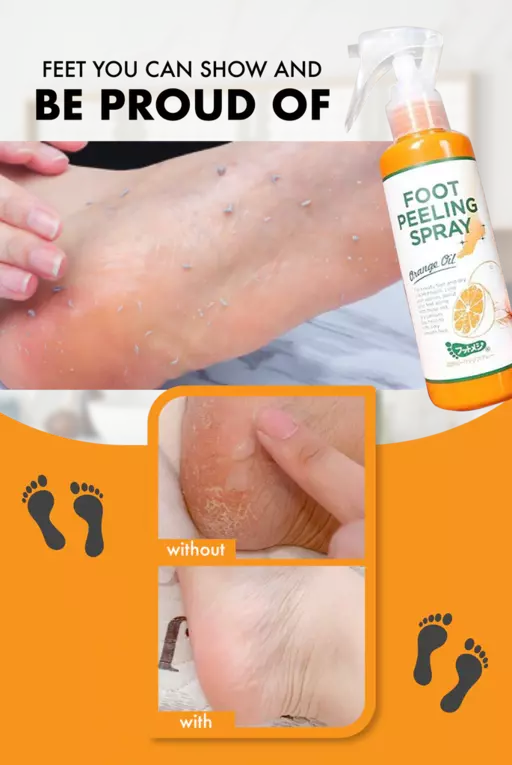 Foot Callus Removal Spray, Foot Peeling Spray That Remove Dead Skin, Feet  Callus Remover, Foot Peeling Spray Orange Oil, Instant Foot Peeling Spray