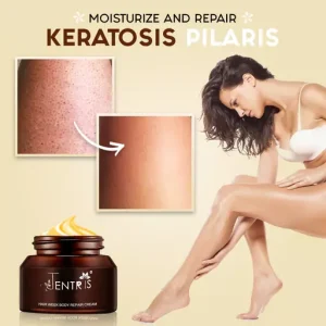 Keratosis Pilaris Repair Cream