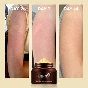 Keratosis Pilaris Repair Cream
