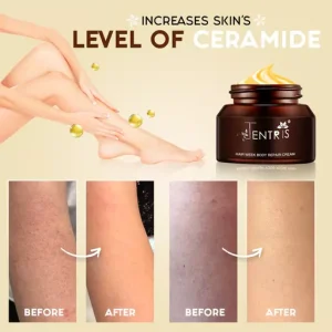 Keratosis Pilaris Repair Cream