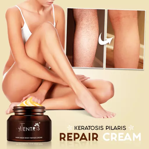 Keratosis Pilaris Repair Cream