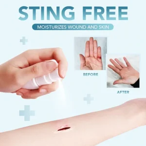 Liquid Band Aid Spray
