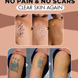 No Regret Tattoo Remove Oil