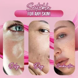 Smooth Skin Microneedle Treatment