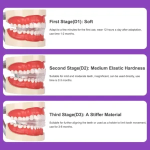 Dental Appliance Tooth Orthodontic Braces Trainer Dental Braces Teeth Trainer Alignment Braces