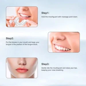Dental Appliance Tooth Orthodontic Braces Trainer Dental Braces Teeth Trainer Alignment Braces