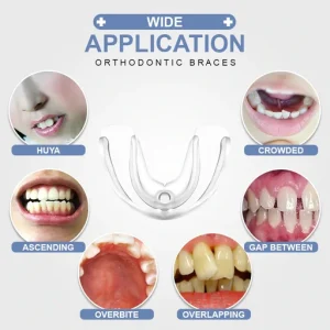 Dental Appliance Tooth Orthodontic Braces Trainer Dental Braces Teeth Trainer Alignment Braces