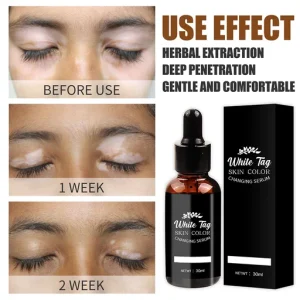 White Tag Skin Color Changing Serum