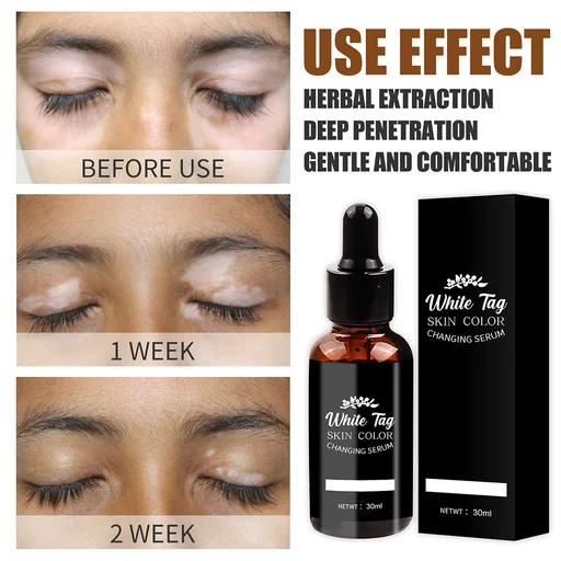 White Tag Skin Color Changing Serum