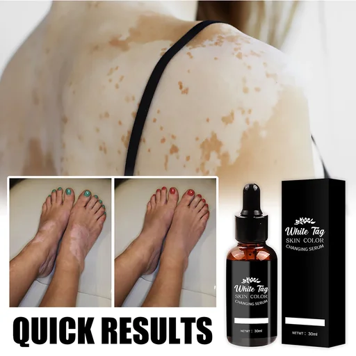 White Tag Skin Color Changing Serum