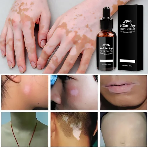 White Tag Skin Color Changing Serum