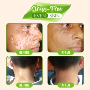 White Tag Skin Color Changing Serum