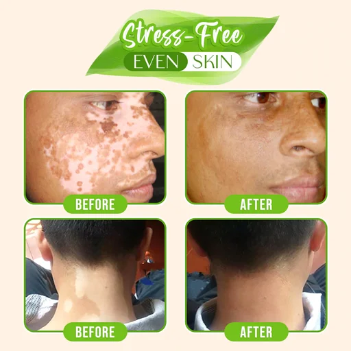 White Tag Skin Color Changing Serum