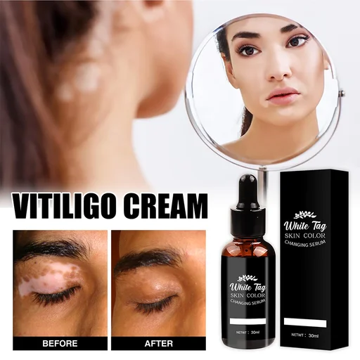 White Tag Skin Color Changing Serum