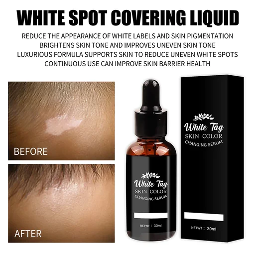 White Tag Skin Color Changing Serum