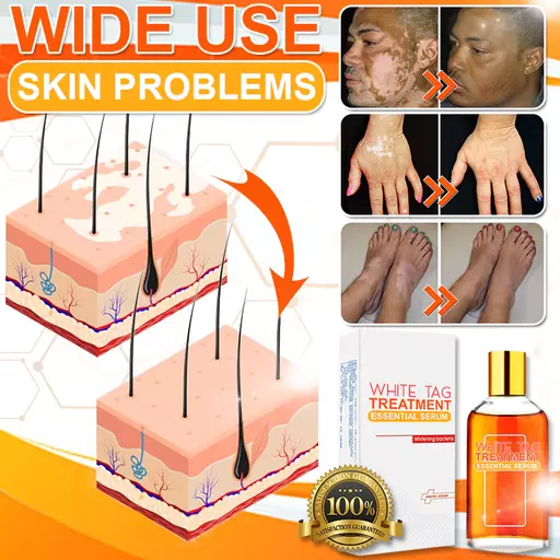 White Tag Treatment Essential Serum