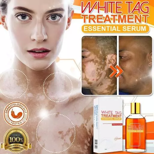 White Tag Treatment Essential Serum