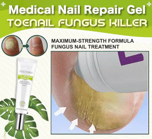 Fungal Nail Treatment Serum Nail Foot Nail Fungus Removal Gel Anti Infection Onychomycosis Nail Repair Essence Cream