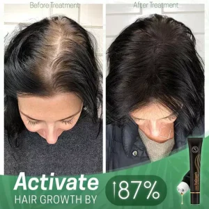 ReGrowth Organic Hair Serum Roller Set Biotin Hair Growth Serum
