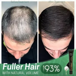 ReGrowth Organic Hair Serum Roller Set Biotin Hair Growth Serum