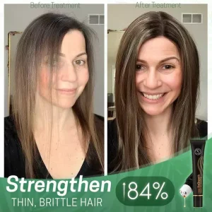 ReGrowth Organic Hair Serum Roller Set Biotin Hair Growth Serum