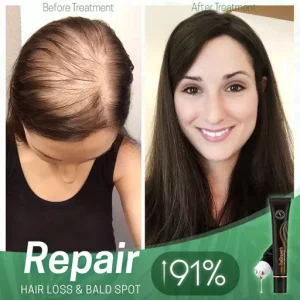 ReGrowth Organic Hair Serum Roller Set Biotin Hair Growth Serum