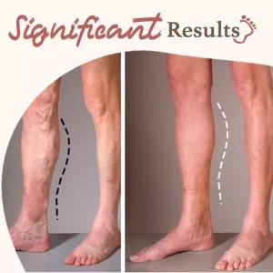 Anti-Fungal Exfoliating Foot Soak