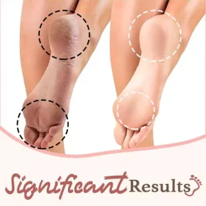 Anti-Fungal Exfoliating Foot Soak