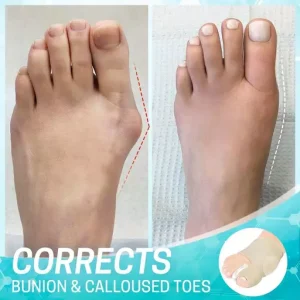 Dr.Fit Bunion Corrector Sleeve