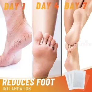Anti Swelling Ginger Detoxing Patch
