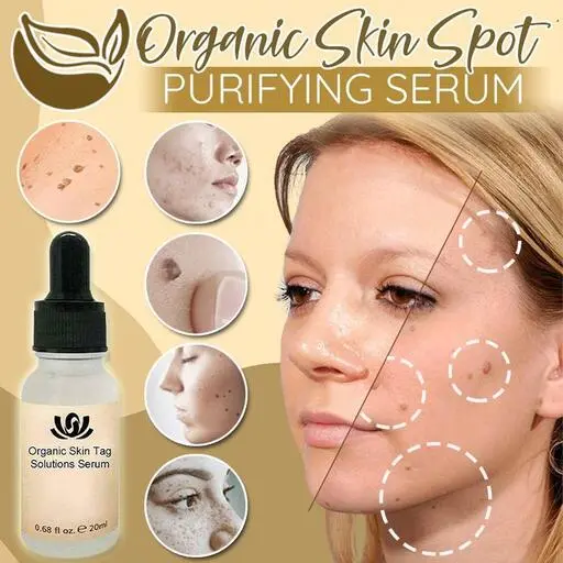 Organic Skin Spot Solutions Serum, Organic Skin Spot Purifying Serum