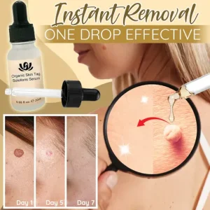 Organic Skin Spot Solutions Serum, Organic Skin Spot Purifying Serum