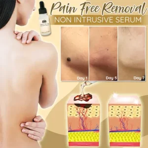 Organic Skin Spot Solutions Serum, Organic Skin Spot Purifying Serum