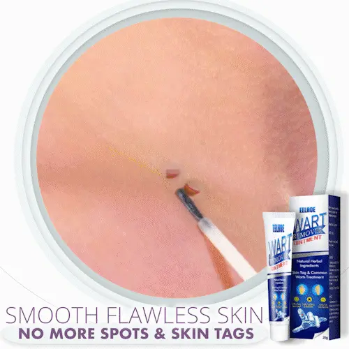 Instant Skin Tag Removal Mousse