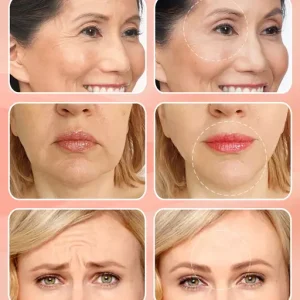 Time Eraser Botox Concentrate Ampoule