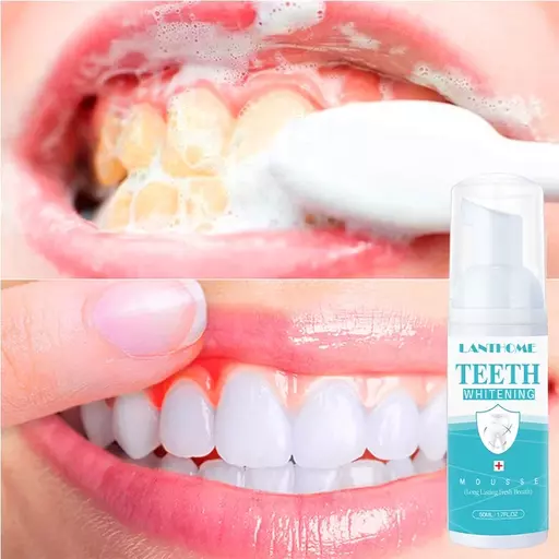 Intensive Stain Removal Toothpaste Cleansing Foam