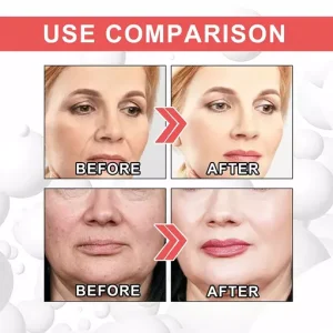 Collagen Boost Anti-Aging Serum