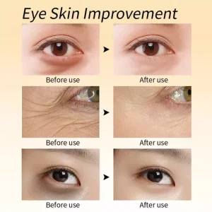 RtopR Mango Revitalize Firming Eye Cream