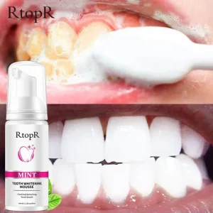 RtopR Mint Tooth Whitening Mousse