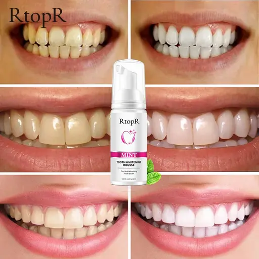 RtopR Mint Tooth Whitening Mousse