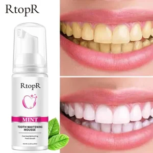 RtopR Mint Tooth Whitening Mousse