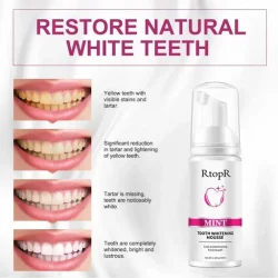 RtopR Mint Tooth Whitening Mousse