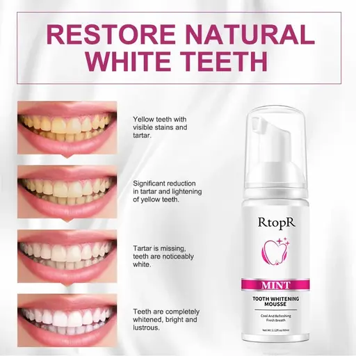 RtopR Mint Tooth Whitening Mousse