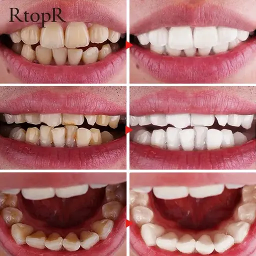 RtopR Mint Tooth Whitening Mousse