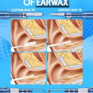 1080P Earwax Removal Camera Tool