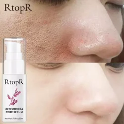 RtopR Glycyrrhiza Face Pore Repair Serum