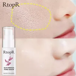 RtopR Glycyrrhiza Face Pore Repair Serum