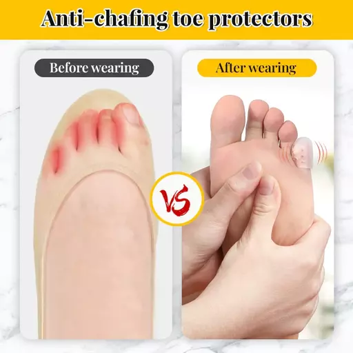 Silicone Little Toe Protectors